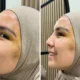 Tya Ariesta Kecelakaan hingga Dapat 8 Jahitan di Wajahnya