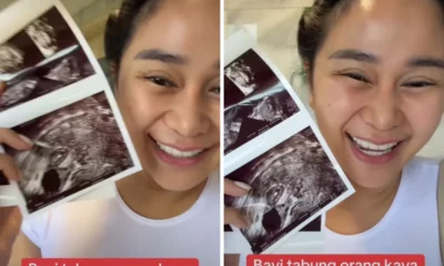 Denise Chariesta Bagikan Momen Jalani Program Bayi Tabung Anak Kembar