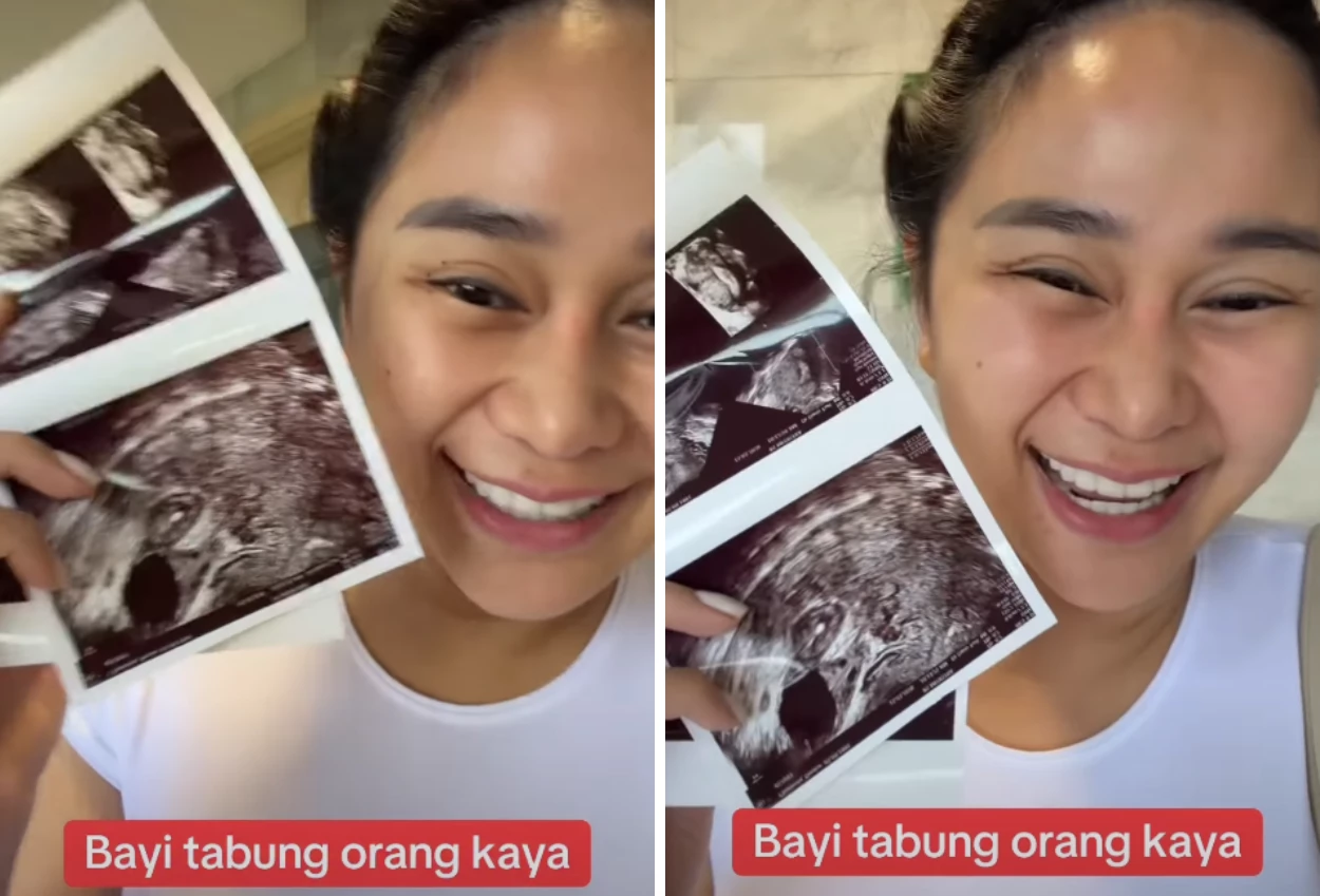 Denise Chariesta Bagikan Momen Jalani Program Bayi Tabung Anak Kembar