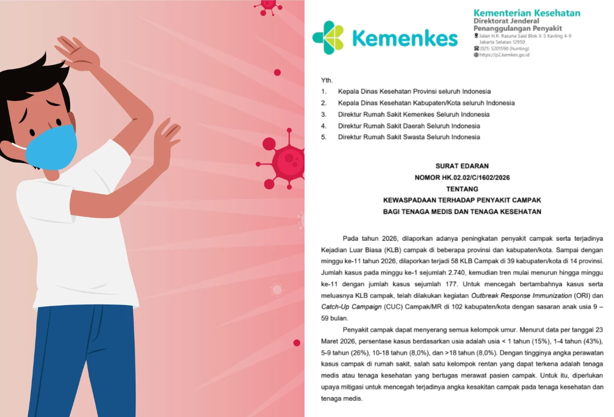 Kemenkes Keluarkan Surat Edaran Waspada Campak untuk Tenaga Medis dan Kesehatan