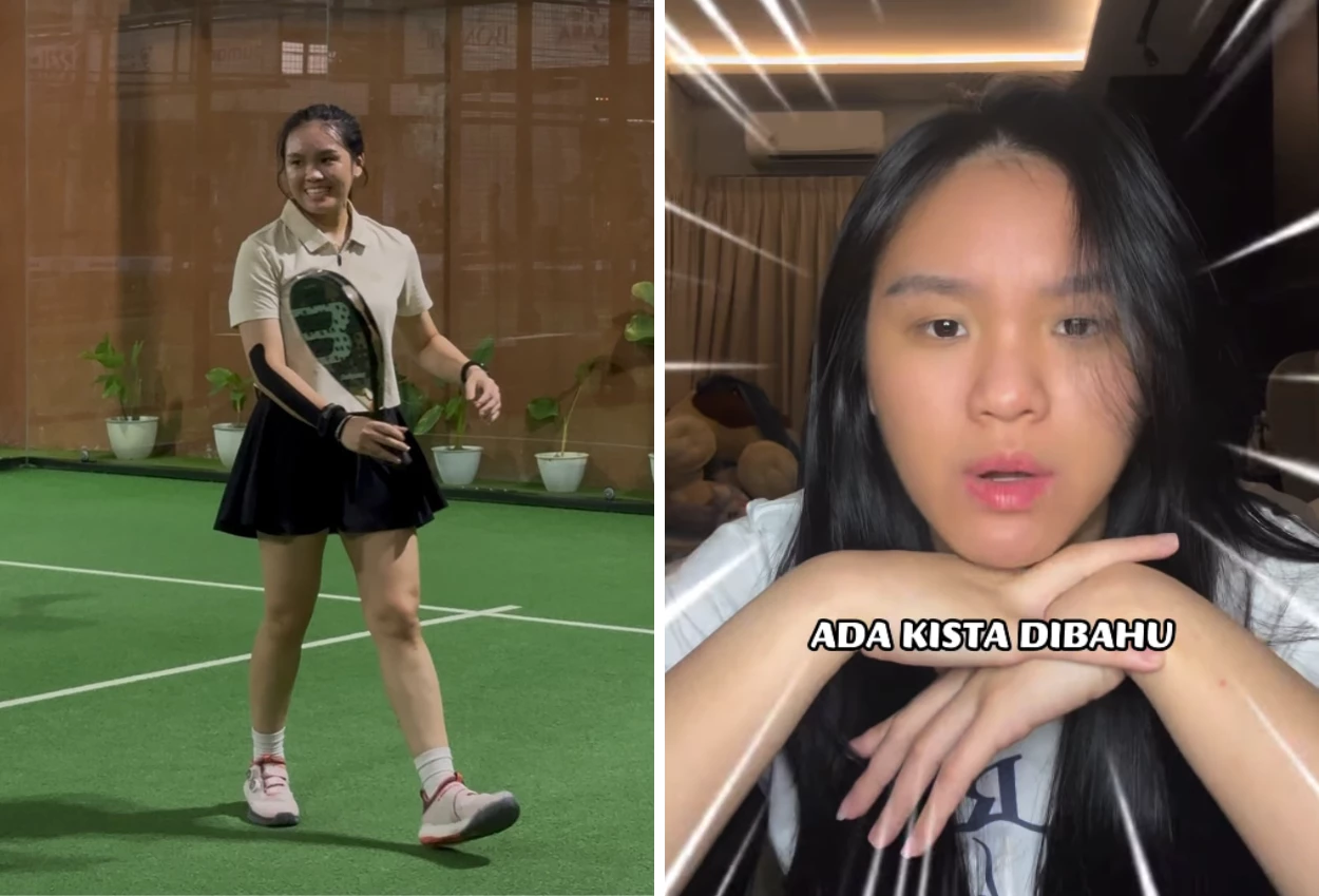 Keseringan Main Padel, Wanita di Jakbar Curhat Kena Kista di Bahu