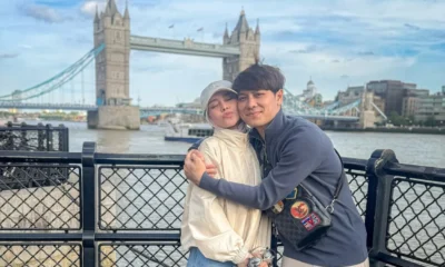 Tak Banyak yang Tahu, Rizky Billar dan Lesti Kejora Adopsi Anak Pengidap Hidrosefalus sejak 6 Bulan Lalu