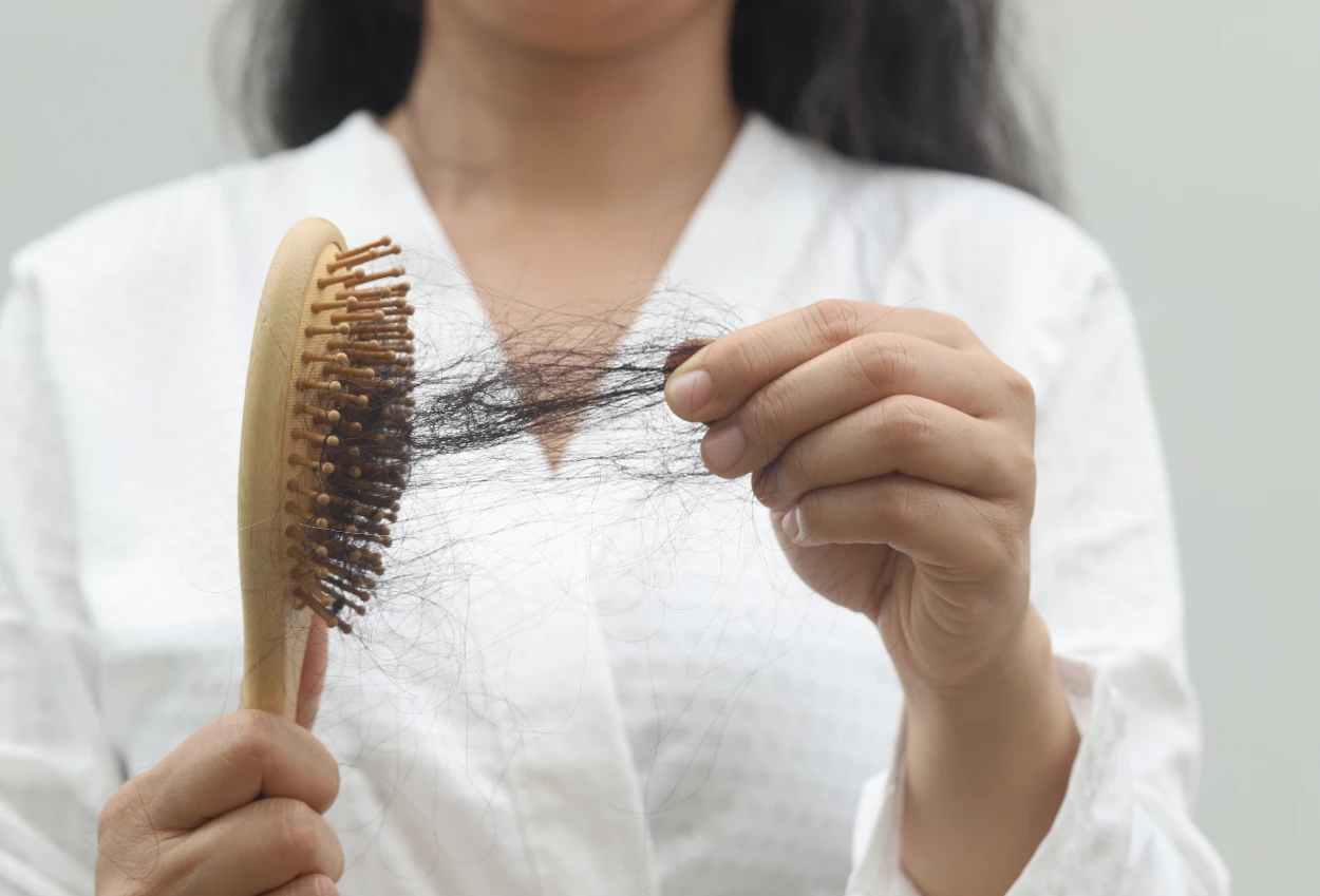 13 Tips Sederhana Mengatasi Rambut Rontok