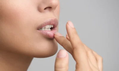 15 Cara Mengatasi Bibir Kering yang Ampuh
