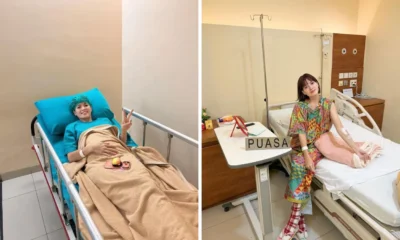 Chika Jessica Jalani Operasi Kista di Perut, Sempat Tahan Sakit hingga Setahun