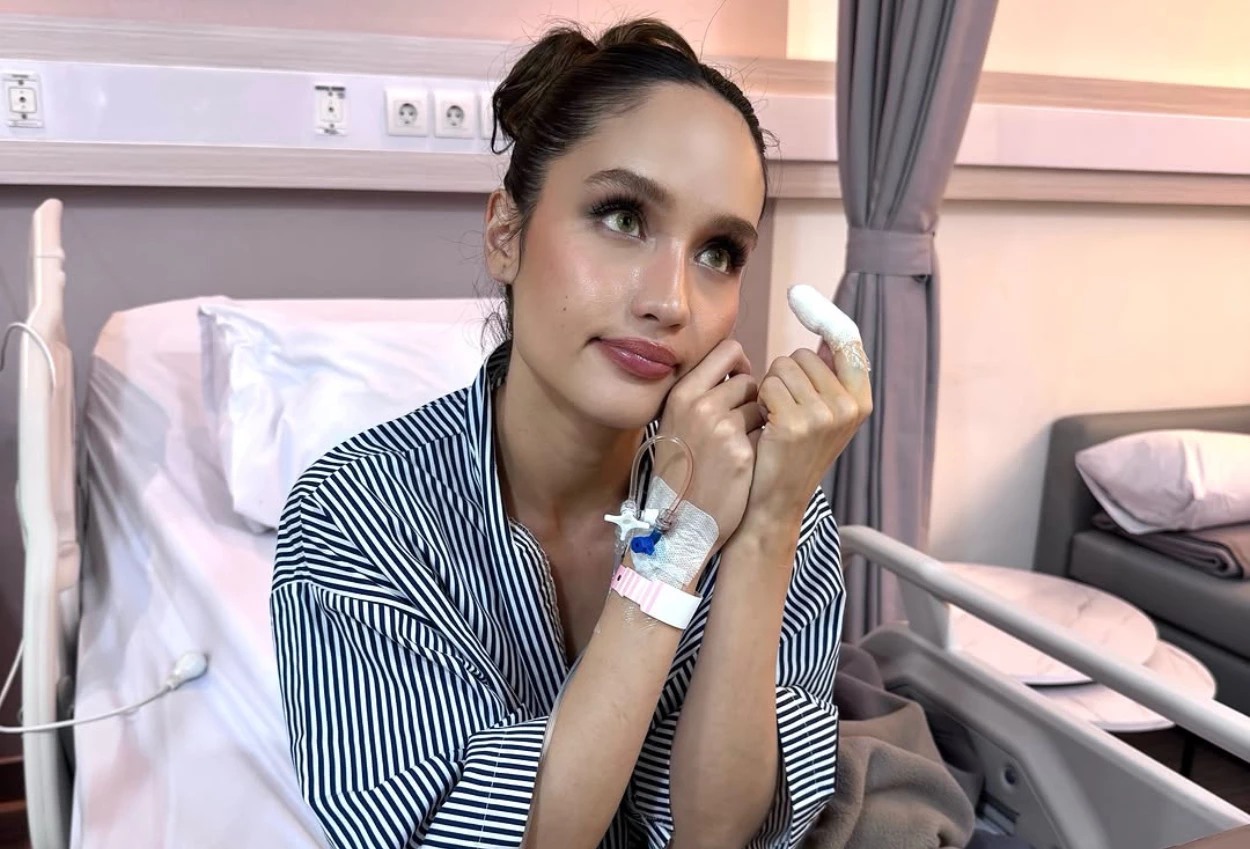 Cinta Laura Tetap Tampil Cantik saat Jalani Operasi Jari karena Teriris Pisau (2)