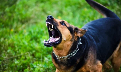 Viral! Bocah 9 Tahun Digigit Anjing Pemburu di Bogor