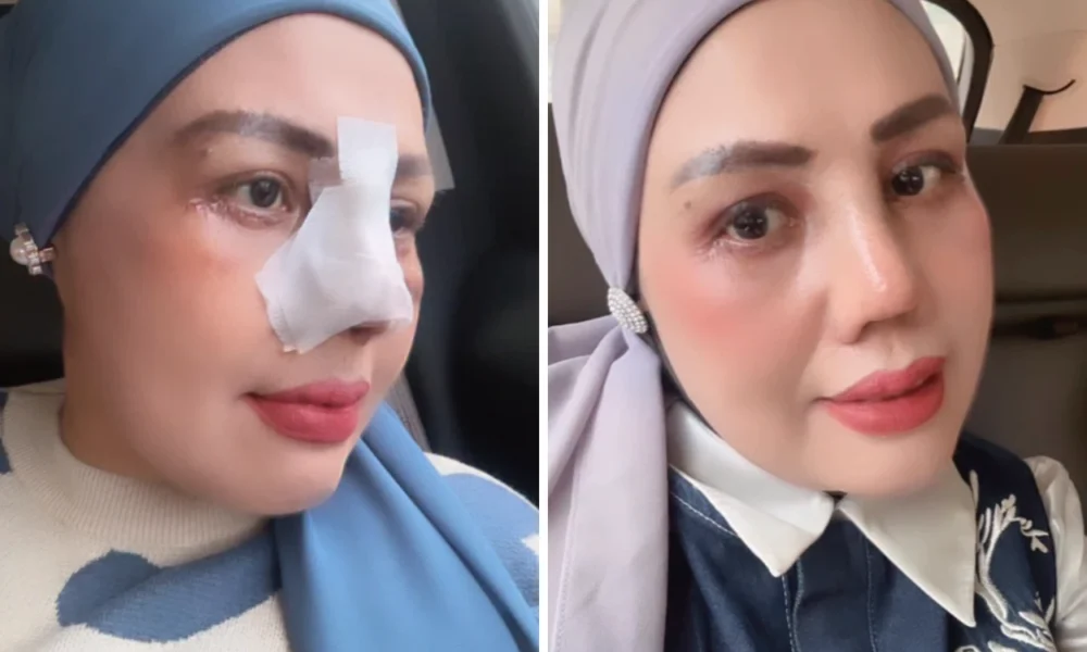 Elly Sugigi Rela Operasi Hidung dan Kelopak Mata, Akui Lelah Dihina Netizen