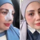 Elly Sugigi Rela Operasi Hidung dan Kelopak Mata, Akui Lelah Dihina Netizen