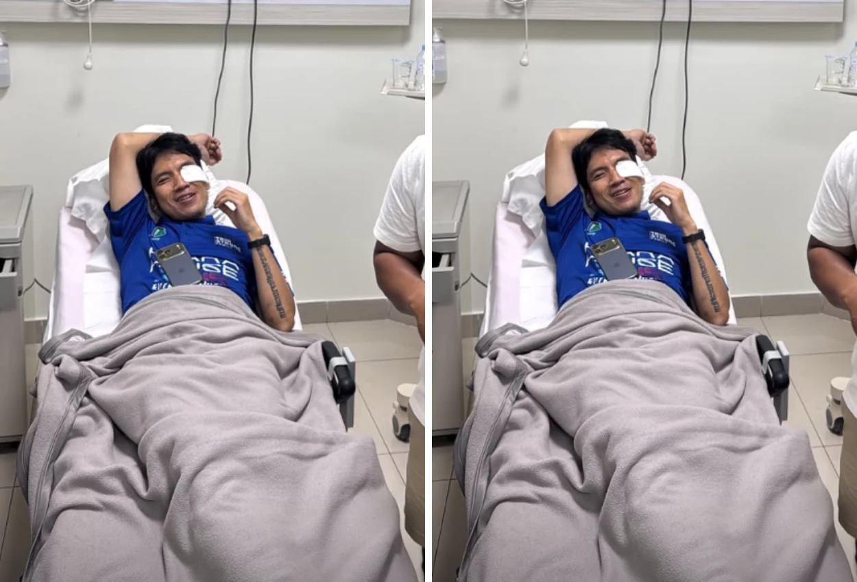 Kondisi Terkini Desta usai Mata Pendarahan karena Kena Bola Padel