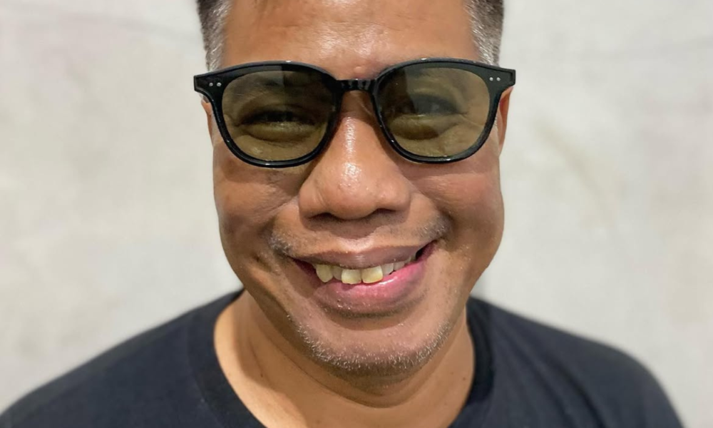 Temon Meninggal karena Apa? Ini Penyebab dan Riwayat Penyakitnya
