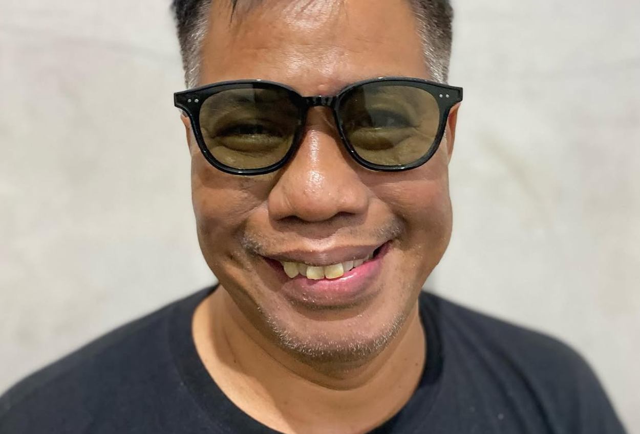 Temon Meninggal karena Apa? Ini Penyebab dan Riwayat Penyakitnya