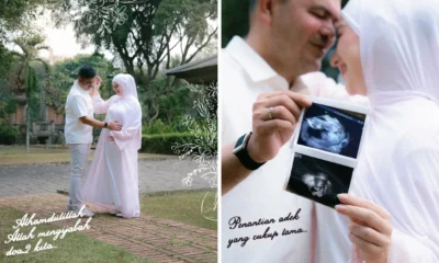 Selamat! Irish Bella Umumkan Kehamilan Ketiga, Unggah Foto USG dan Pamer Baby Bump