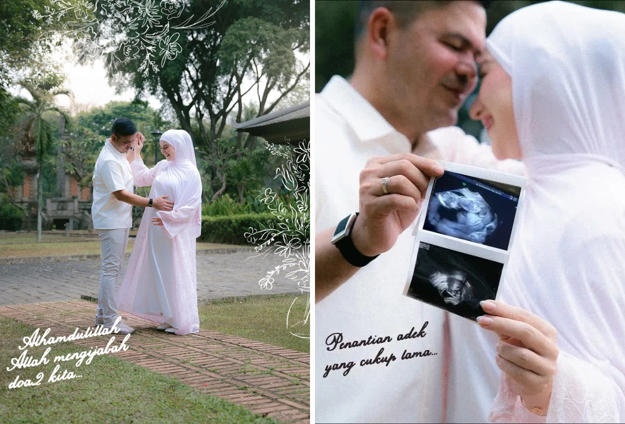 Selamat! Irish Bella Umumkan Kehamilan Ketiga, Unggah Foto USG dan Pamer Baby Bump