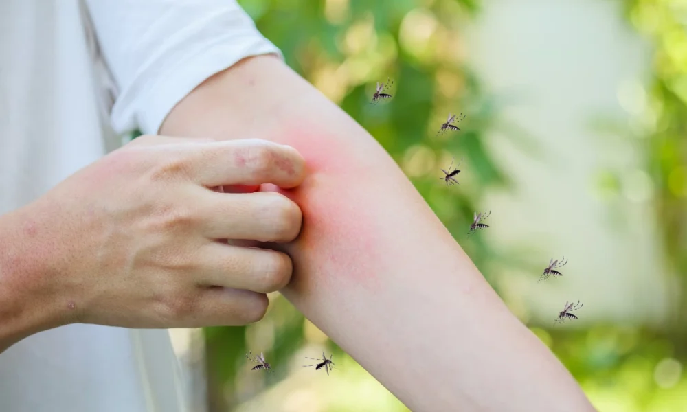 10 Cara Hilangkan Nyamuk secara Alami, Tidur Nyenyak Tanpa Garuk Garuk