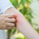 10 Cara Hilangkan Nyamuk secara Alami, Tidur Nyenyak Tanpa Garuk Garuk