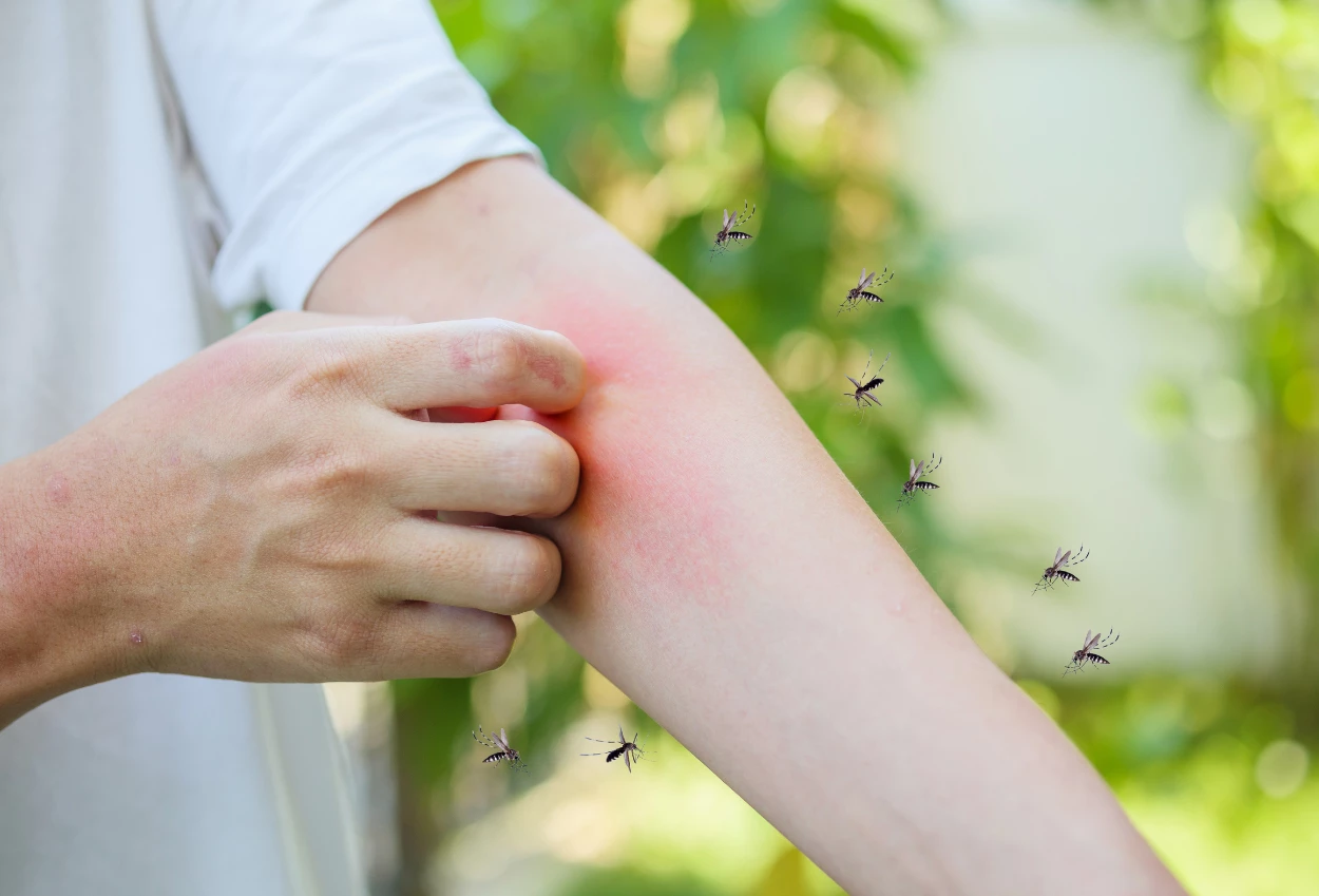 10 Cara Hilangkan Nyamuk secara Alami, Tidur Nyenyak Tanpa Garuk Garuk