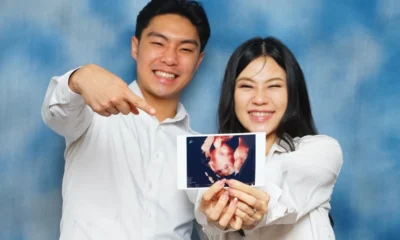 Jessica Jane Umumkan Hamil Anak Pertama, Pamer Hasil USG bersama Suami