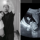 Selamat! Maudy Ayunda Umumkan Hamil Anak Pertama, Pamer USG hingga Baby Bump