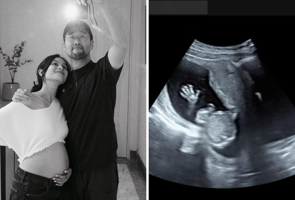 Selamat! Maudy Ayunda Umumkan Hamil Anak Pertama, Pamer USG hingga Baby Bump