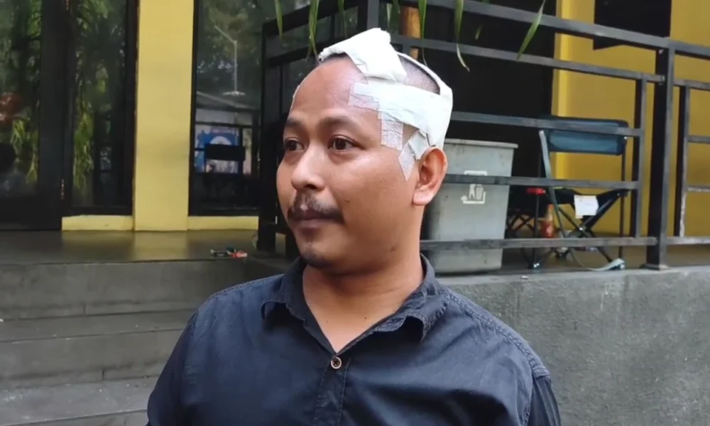 Sopir Taksi Online Korban Begal di Pamulang Datangi Polda Metro Jaya dengan Perban di Kepala