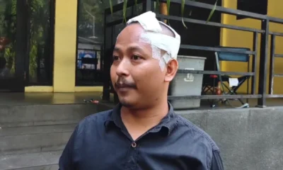 Sopir Taksi Online Korban Begal di Pamulang Datangi Polda Metro Jaya dengan Perban di Kepala